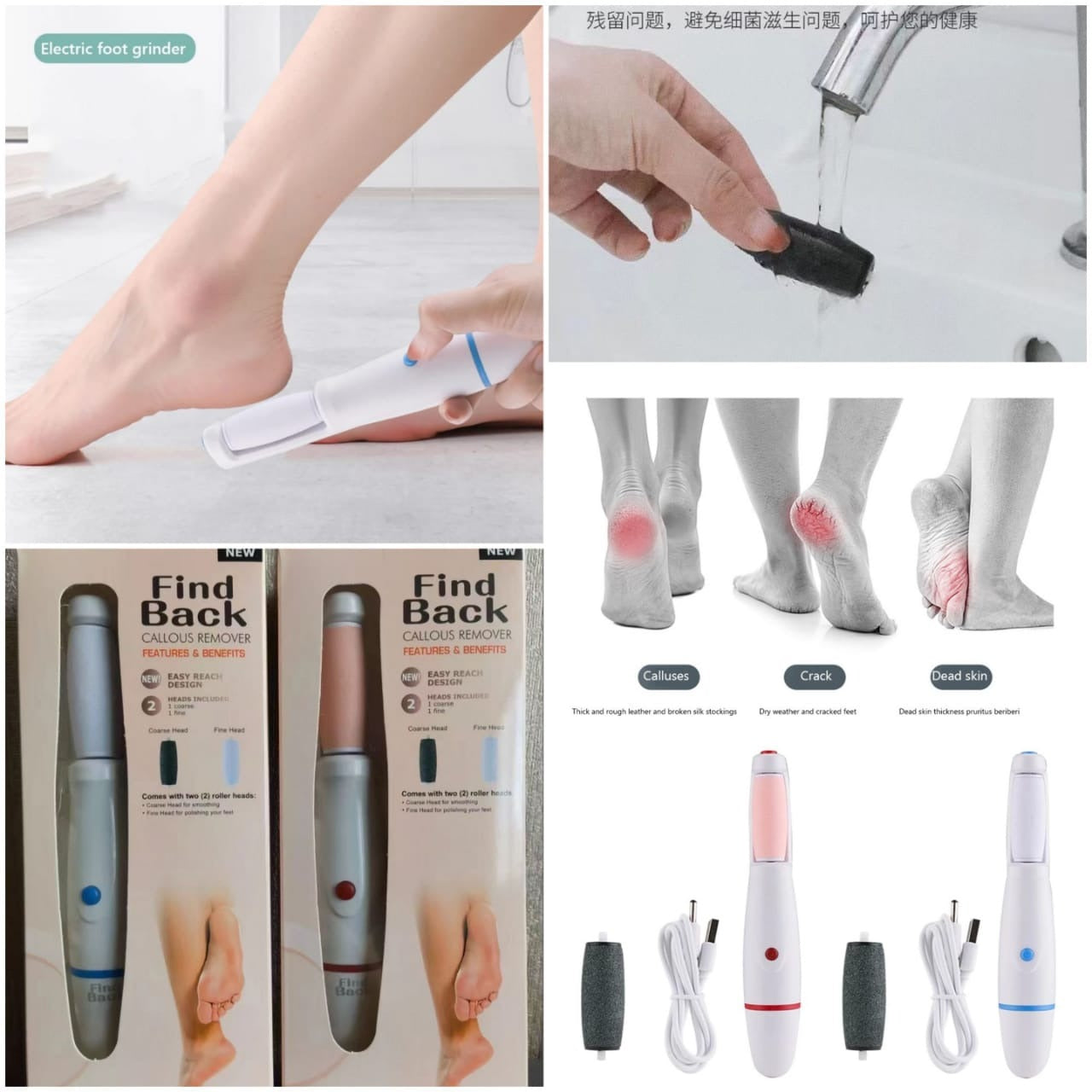 Find Back Callus Remover | Electric Pedicure Tool